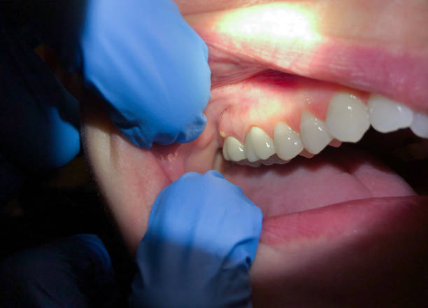 Best Teeth Whitening  in Oak Park Heights, MN
