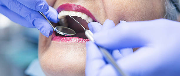 Best Chipped Tooth Repair Near Me  in Oak Park Heights, MN